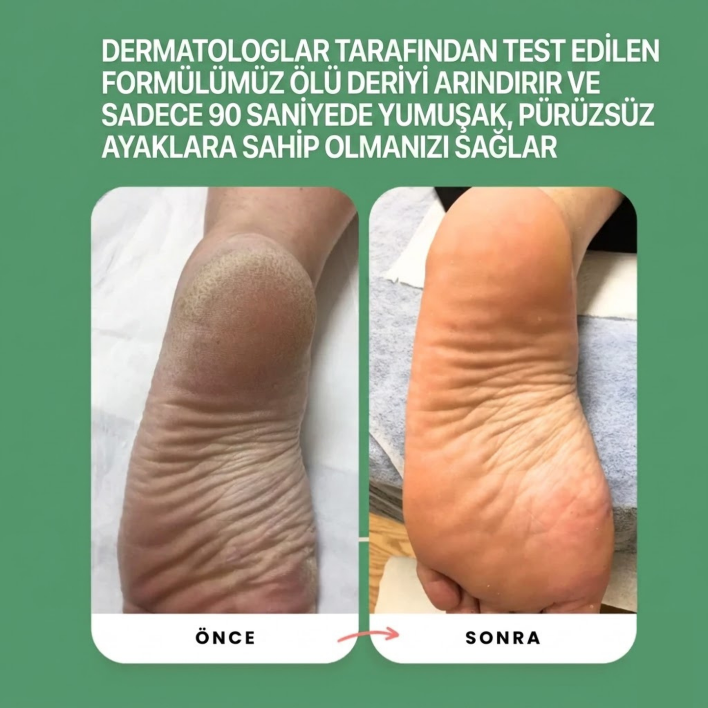 Ayak Peeling Spreyi